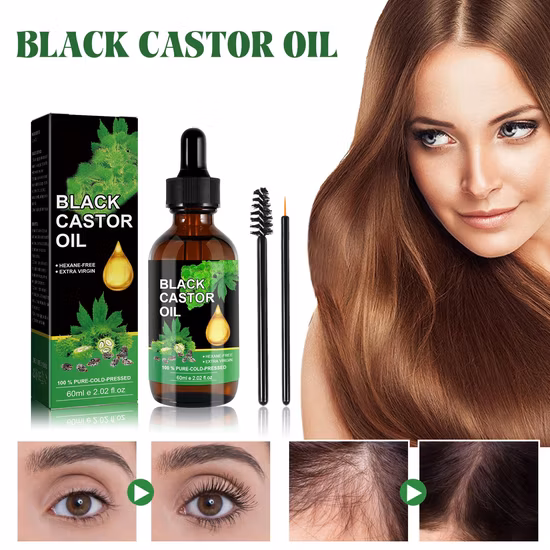 Minoxidil Productos para el cabello para un crecimiento saludable del cabello 60 ml Kirkland 5 % Aceite para el crecimiento del cabello